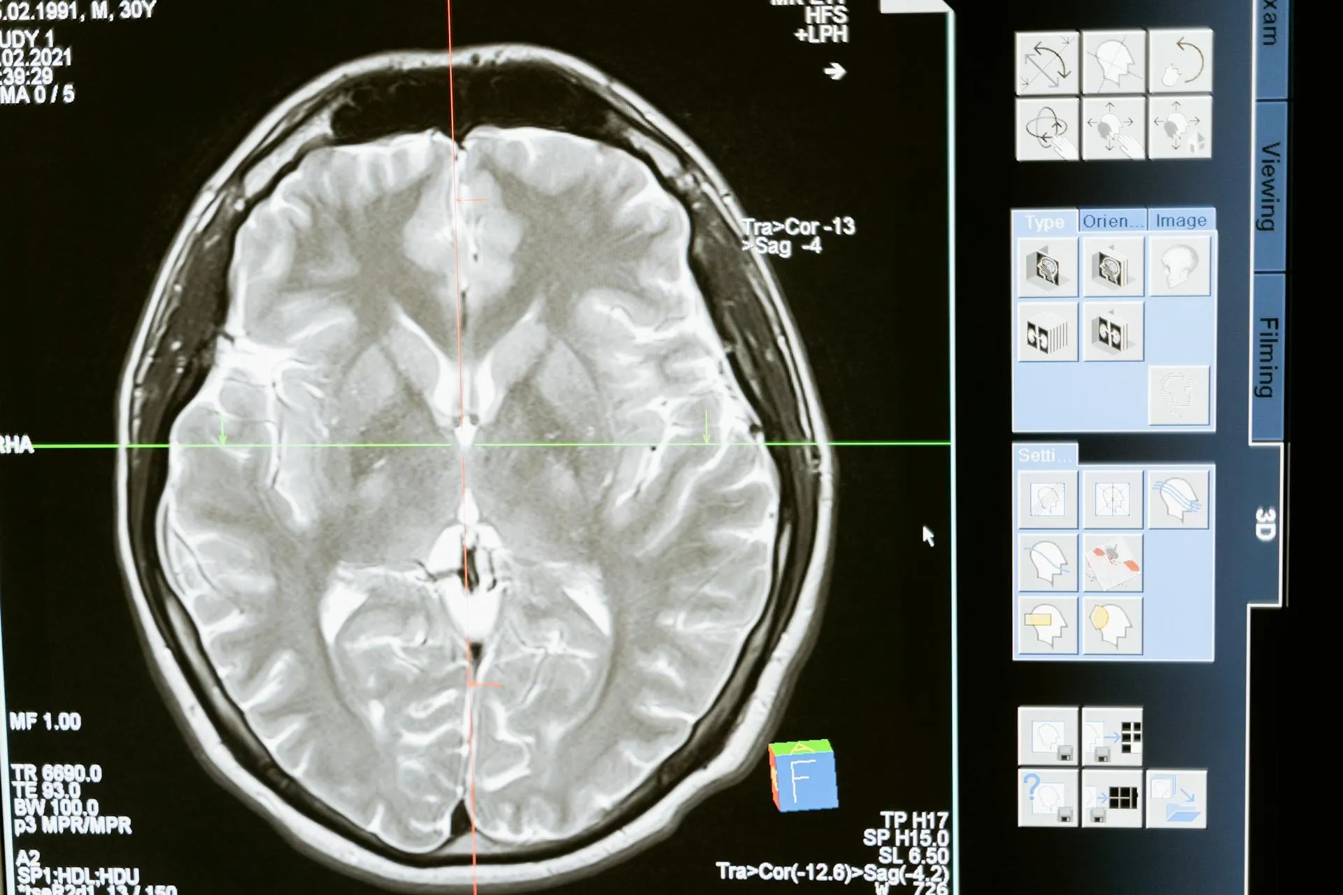 Neuroscience